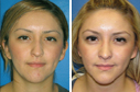 Before & After Photos